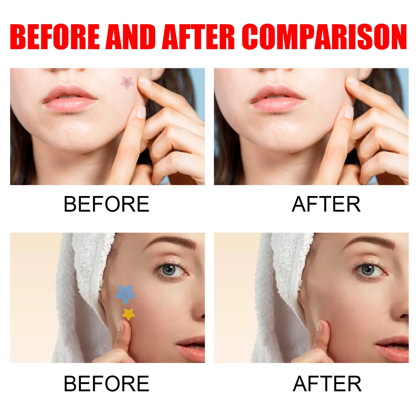 Repair Acne Patch Facial Skin Care Fade Blemishes Pimple Marks Closed Acne Blemishes Cover Acne Pimple Repair Patch