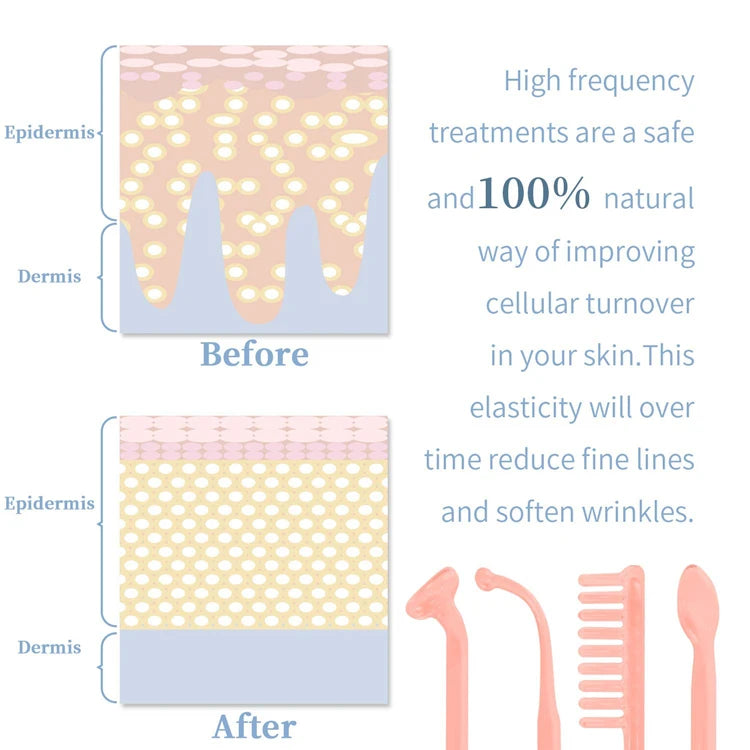 High Frequency Skin Therapy Wand Machine Portable Handheld for Acne Massage Skin Rejuvenation Tightening Wrinkle Reducing Tool